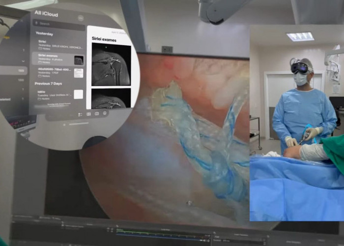Terobosan! Dokter Ortopedi Brasil Gunakan Apple Vision Pro untuk Operasi Artroskopi Bahu
