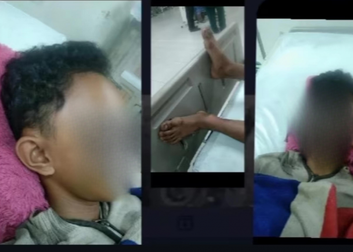 Seorang Anak di Bawah Umur jadi Korban Fitnah dan Pengeroyokan Massal, Keluarga Minta Keadilan