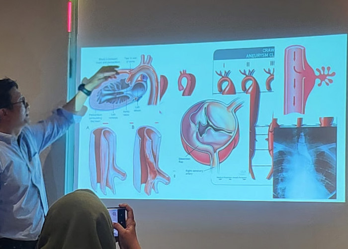 Kecepatan Menjadi Kunci Penyelamatan Nyawa pada Penanganan Penyakit Aorta Kompleks di Era Modern