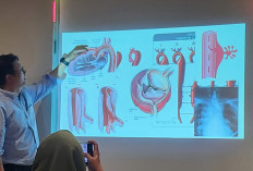 Kecepatan Menjadi Kunci Penyelamatan Nyawa pada Penanganan Penyakit Aorta Kompleks di Era Modern