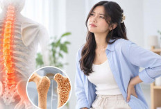 Merasa Sehat? Belum Tentu Tulangmu Kuat Osteoporosis Bukan Cuma untuk Lansia